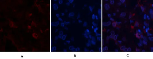 Immunofluorescence analysis of human-lung-cancer tissue. 1,ABCG2 Polyclonal Antibody（red） was diluted at 1:200（4°C,overnight）. 2, Cy3 labled Secondary antibody was diluted at 1:300（room temperature, 50min）.3, Picture B: DAPI（blue） 10min. Picture A:Target. Picture B: DAPI. Picture C: merge of A+B