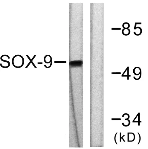 Western blot analysis of lysates from 293 cells, treated with PBS 60', using SOX9 Antibody. The lane on the right is blocked with the synthesized peptide.