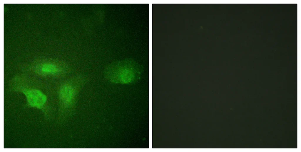 Immunofluorescence analysis of HepG2 cells, using HDAC6 (Phospho-Ser22) Antibody. The picture on the right is blocked with the phospho peptide.