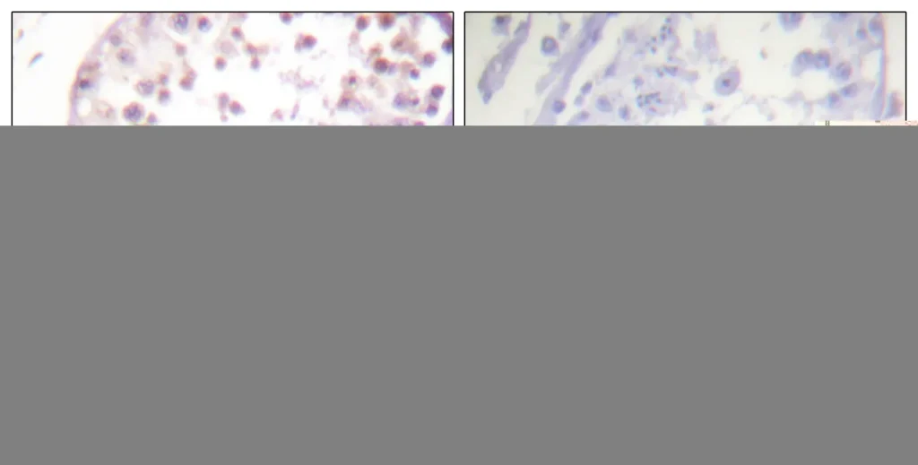 Immunohistochemistry analysis of paraffin-embedded human testis, using HDAC6 (Phospho-Ser22) Antibody. The picture on the right is blocked with the phospho peptide.