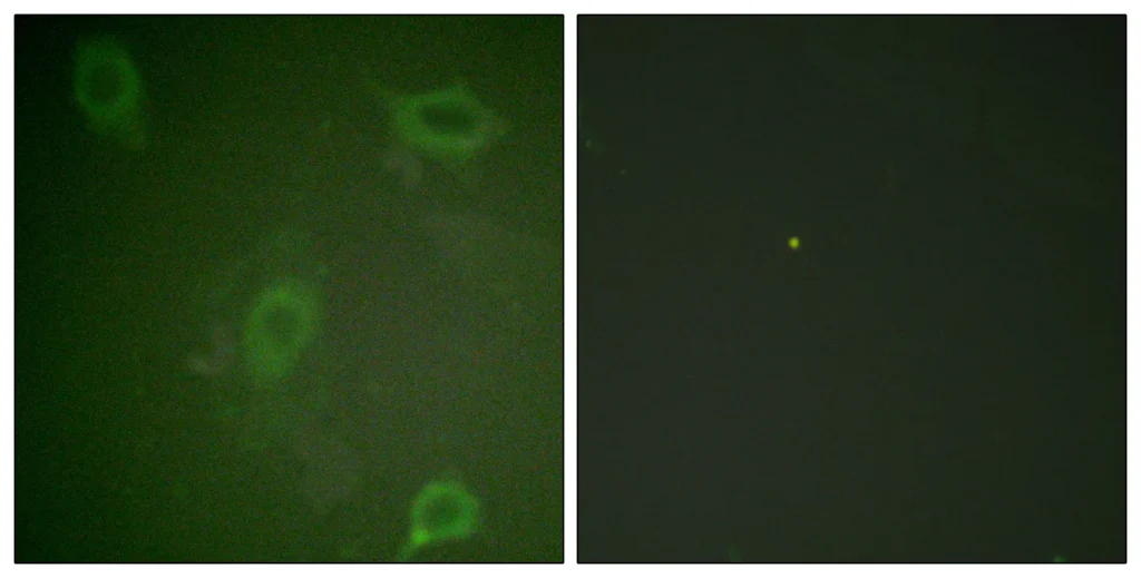 Enzyme-Linked Immunosorbent Assay (Phospho-ELISA) for Immunogen Phosphopeptide (Phospho-left) and Non-Phosphopeptide (Phospho-right), using Amyloid beta A4 (Phospho-Thr743/668) Antibody