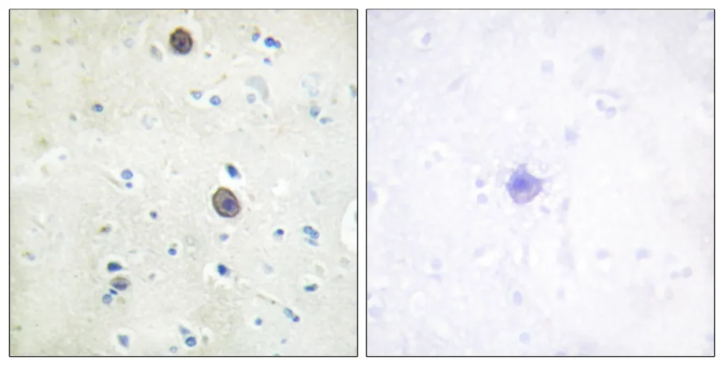 Immunofluorescence analysis of HeLa cells, using Amyloid beta A4 (Phospho-Thr743/668) Antibody. The picture on the right is blocked with the phospho peptide.
