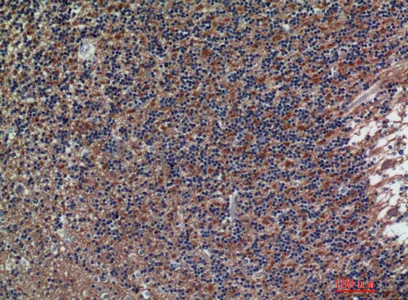 Immunohistochemical analysis of paraffin-embedded human-brain, antibody was diluted at 1:200