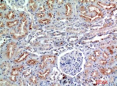 Immunohistochemical analysis of paraffin-embedded human-kidney, antibody was diluted at 1:200