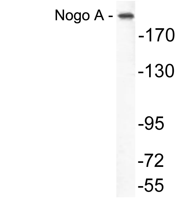 Western blot analysis of lysate from COLO205 cells, using Nogo A antibody.