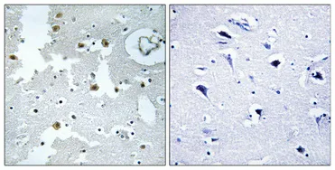 Immunohistochemical analysis of paraffin-embedded Human brain. Antibody was diluted at 1:100（4°,overnight）. High-pressure and temperature Tris-EDTA,pH8.0 was used for antigen retrieval. Negetive contrl （right） obtaned from antibody was pre-absorbed by immunogen peptide.