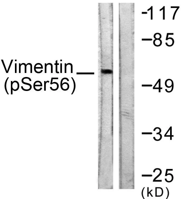 Western blot analysis of lysates from A549 cells treated with Nocodazole 1ug/ml 16h, using Vimentin (Phospho-Ser56) Antibody. The lane on the right is blocked with the phospho peptide.
