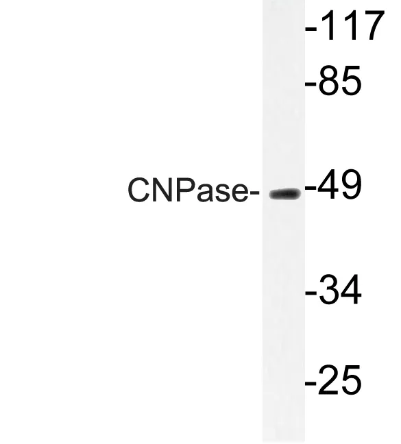 Western blot analysis of lysate from HUVEC cells, using CNPase antibody.