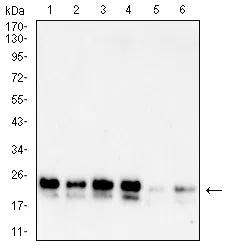 Western blot analysis using PARK7 mouse mAb against A549 (1), A431 (2),K562 (3),Hela(4), SH-SY5Y (5) and SW480 (6) cell lysate.
