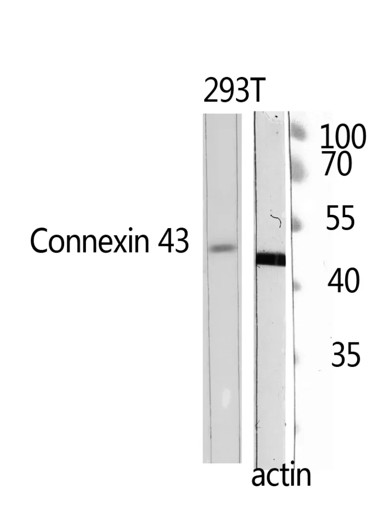 Western Blot analysis of 293T using Doublecortin Polyclonal Antibody. Antibody was diluted at 1:500