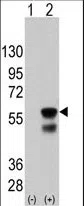 Western blot analysis of PINK (arrow) using mouse monoclonal PINK antibody(Ascites). 293 cell lysates (2 μg/lane) either nontransfected (Lane 1) or transiently transfected with the PINK gene (Lane 2) (Origene Technologies) (1:2000)