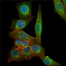 Immunofluorescence analysis of PANC-1 cells using TUBB3 mouse mAb (green). Blue: DRAQ5 fluorescent DNA dye. Red: Actin filaments have been labeled with Alexa Fluor-555 phalloidin.