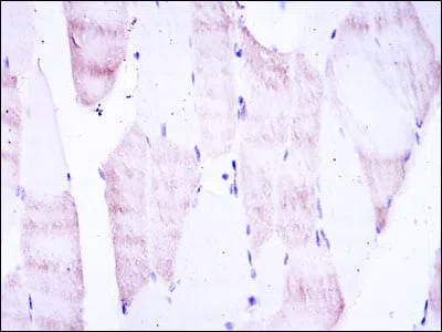 Immunohistochemical analysis of paraffin-embedded human muscle tissues using OLIG2 mouse mAb with DAB staining.