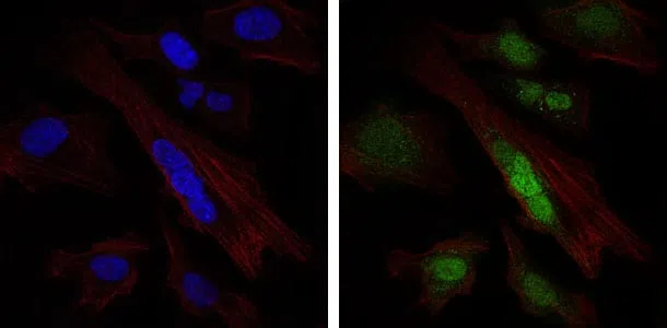 Immunofluorescence analysis of Hela cells using SOX9 mouse mAb (green). Blue: DRAQ5 fluorescent DNA dye. Red: Actin filaments have been labeled with Alexa Fluor-555 phalloidin.