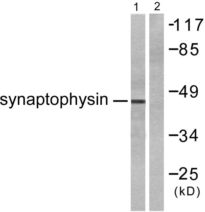 Western blot analysis of lysates from LOVO cells, using Synaptophysin Antibody. The lane on the right is blocked with the synthesized peptide.