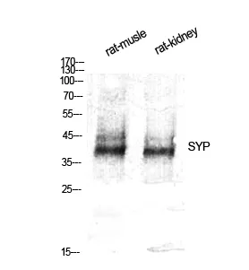 Western Blot analysis of various cells using SYP Polyclonal Antibody diluted at 1：500
