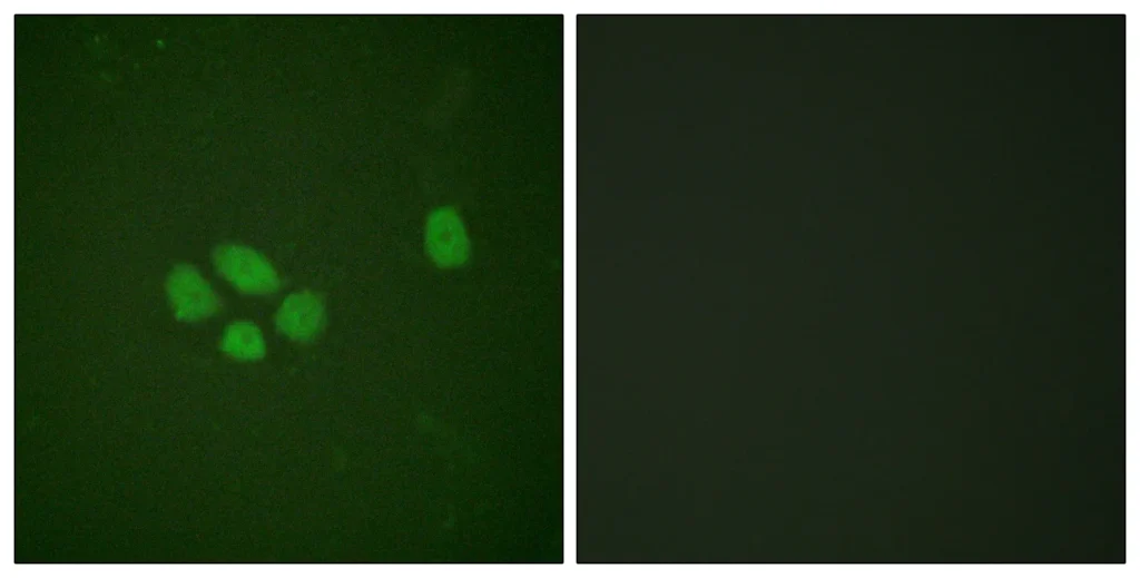 Immunofluorescence analysis of A549 cells, using SOX-9 (Phospho-Ser181) Antibody. The picture on the right is blocked with the phospho peptide.