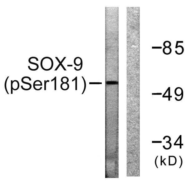 Western blot analysis of lysates from 293 cells treated with PBS 60', using SOX-9 (Phospho-Ser181) Antibody. The lane on the right is blocked with the phospho peptide.