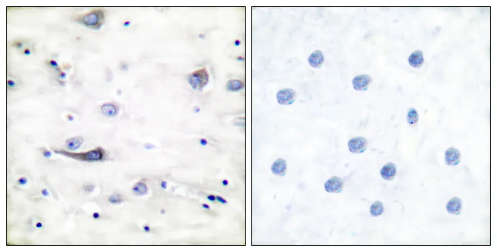 Immunohistochemistry analysis of paraffin-embedded human brain, using GluR1 (Phospho-Ser863) Antibody. The picture on the right is blocked with the phospho peptide.
