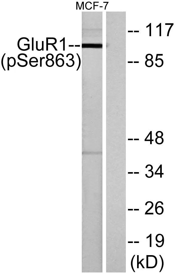 Western blot analysis of lysates from MCF-7 cells, using GluR1 (Phospho-Ser863) Antibody. The lane on the right is blocked with the phospho peptide.