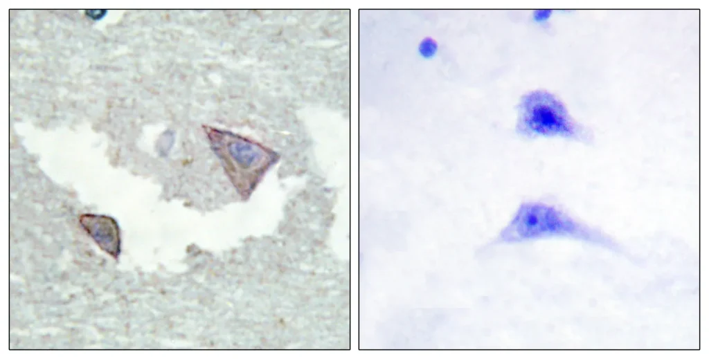 Immunohistochemistry analysis of paraffin-embedded human brain, using PDGFR alpha (Phospho-Tyr754) Antibody. The picture on the right is blocked with the phospho peptide.