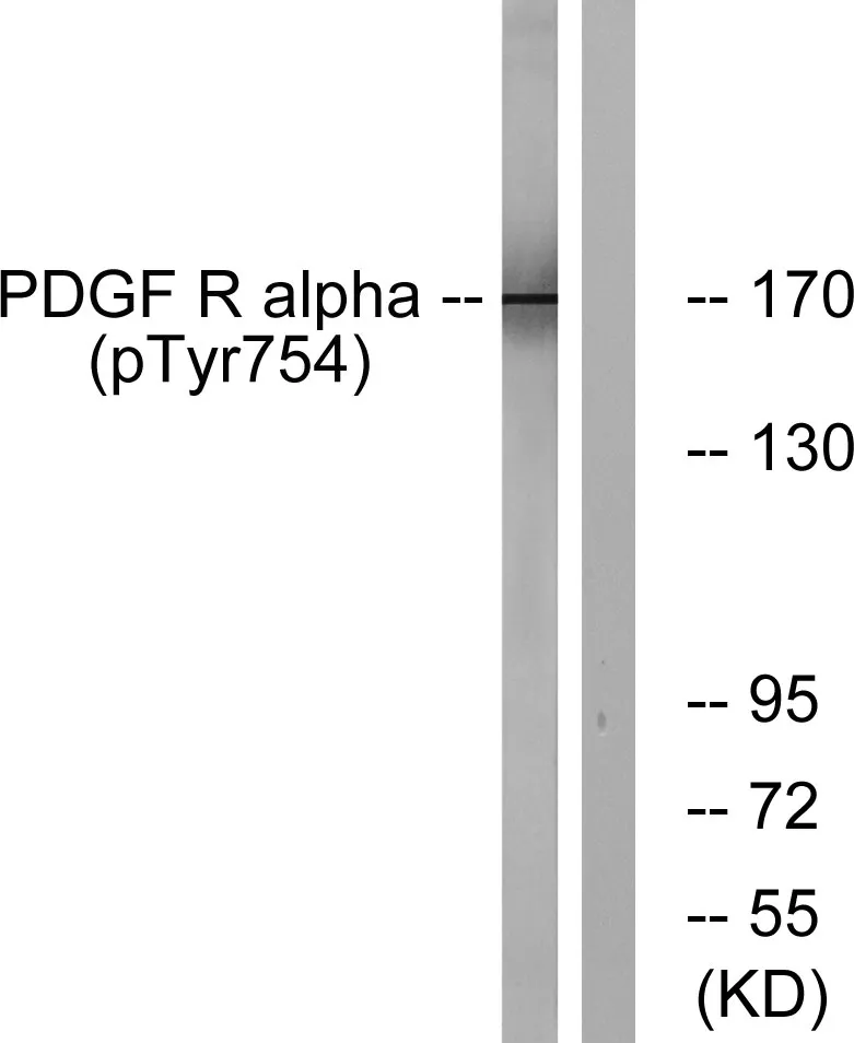 Western blot analysis of PDGFR alpha (Phospho-Tyr754) Antibody. The lane on the right is blocked with the PDGFR alpha (Phospho-Tyr754) peptide.