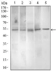 Western blot analysis using PAX3 mouse mAb against A549 (1), A431 (2), Jurkat (3), Rat spleen (4) and Mouse liver (5) cell lysate.
