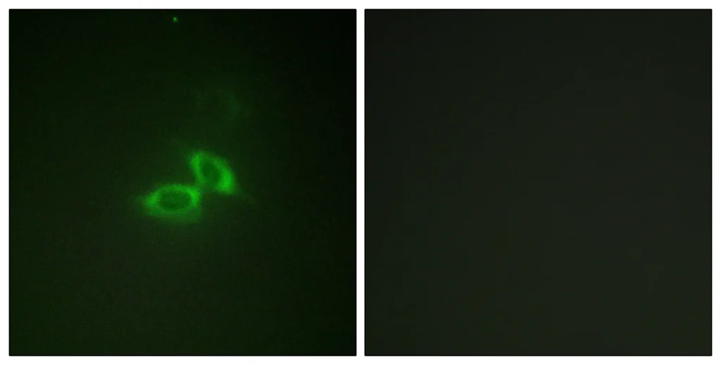 Immunofluorescence analysis of NIH/3T3 cells, using NMDAR1 Antibody. The picture on the right is blocked with the synthesized peptide.