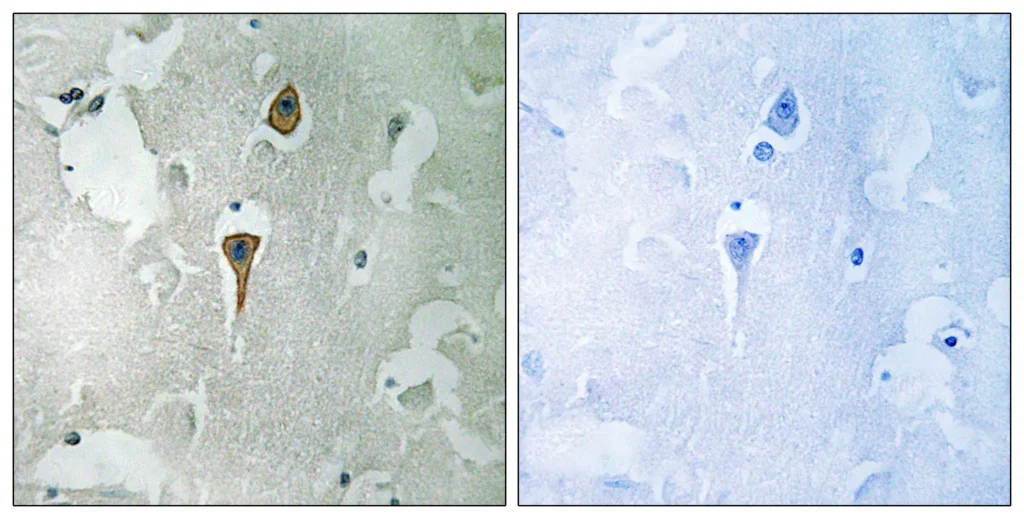 Immunohistochemistry analysis of paraffin-embedded human brain tissue, using NMDAR1 Antibody. The picture on the right is blocked with the synthesized peptide.