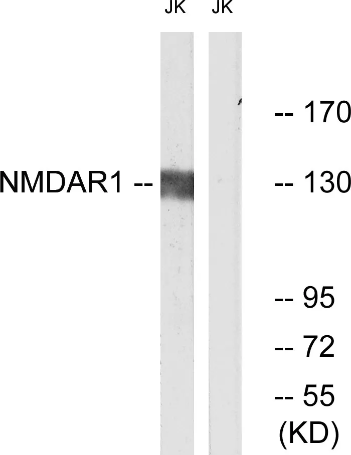 Western blot analysis of lysates from Jurkat cells, using NMDAR1 Antibody. The lane on the right is blocked with the synthesized peptide.