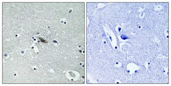 Immunohistochemical analysis of paraffin-embedded Human brain. Antibody was diluted at 1:100(4°,overnight). High-pressure and temperature Tris-EDTA,pH8.0 was used for antigen retrieval. Negetive contrl (right) obtaned from antibody was pre-absorbed by immunogen peptide.