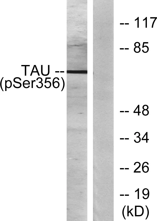 Western blot analysis of lysates from 293 cells treated with serum 10% 15', using Tau (Phospho-Ser356) Antibody. The lane on the right is blocked with the phospho peptide.