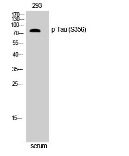 Western Blot analysis of NIH-3T3 cells using Phospho-Tau (S356) Polyclonal Antibody diluted at 1:500