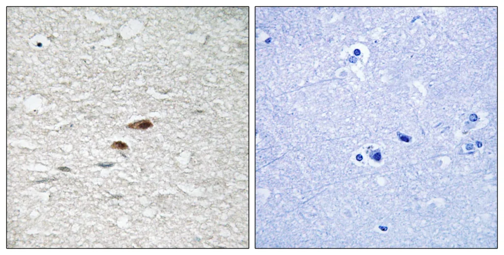 Immunohistochemistry analysis of paraffin-embedded human brain, using APC (Phospho-Ser2054) Antibody. The picture on the right is blocked with the phospho peptide.