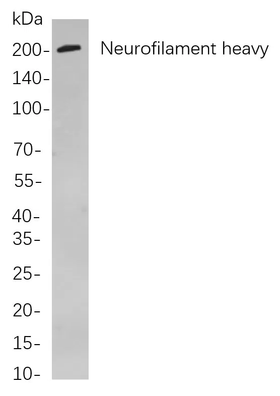Western blot analysis of lysates from Mouse brain cells, using Neurofilament heavy polypeptide Rabbit mAb. The HRP-conjugated Goat anti-Rabbit IgG antibody was used to detect the antibody.
