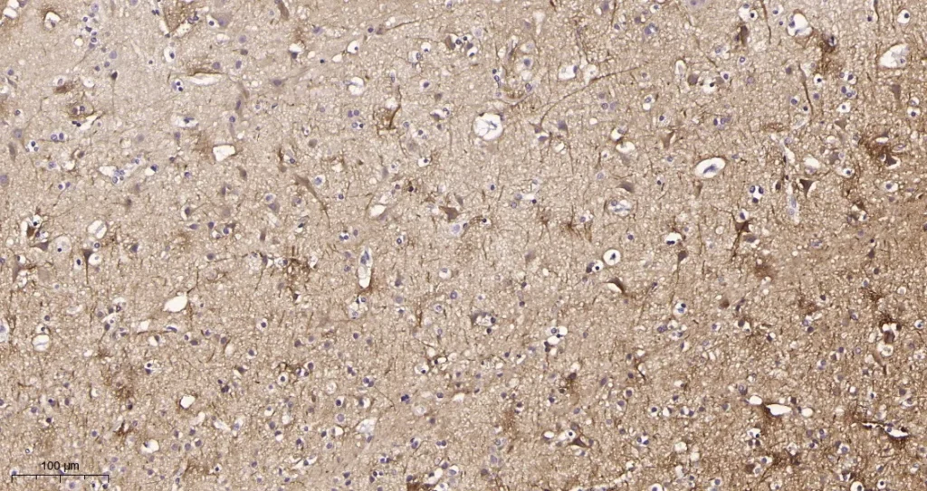 Immunohistochemical analysis of paraffin-embedded human brain tissue. 1, Neurofilament heavy polypeptide Rabbit Monoclonal Antibody was diluted at 1:200(4°C,overnight). 2, EDTA pH 9.0 was used for antibody retrieval(>98°C,20min). 3,Secondary antibody was diluted at 1:200(room temperature, 30min).