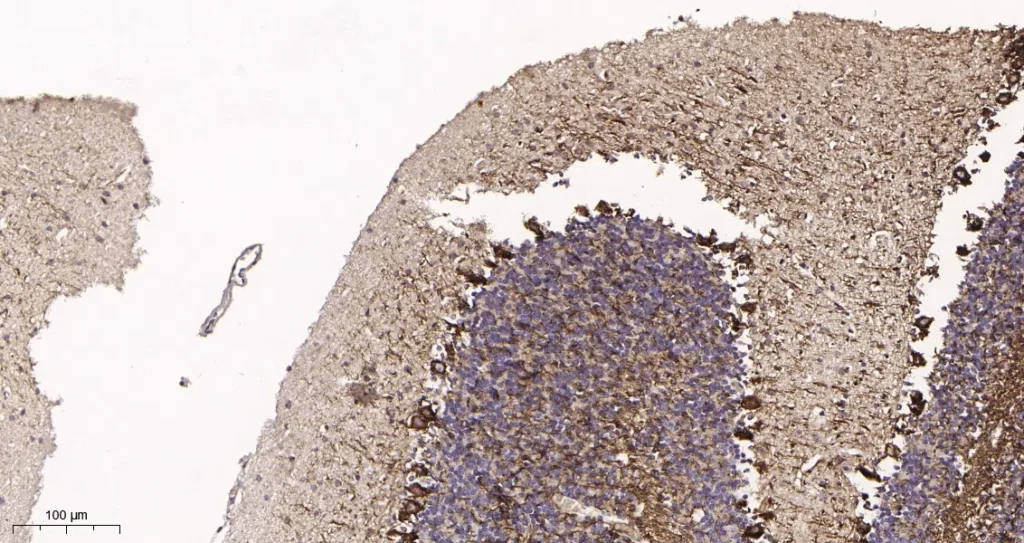 Immunohistochemical analysis of paraffin-embedded mouse brain tissue. 1, Neurofilament heavy polypeptide Rabbit Monoclonal Antibody was diluted at 1:200(4°C,overnight). 2, EDTA pH 9.0 was used for antibody retrieval(>98°C,20min). 3,Secondary antibody was diluted at 1:200(room temperature, 30min).
