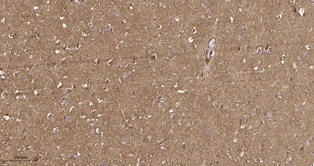Immunohistochemical analysis of paraffin-embedded human brain tissue. 1, EAAT1 Rabbit Monoclonal Antibody was diluted at 1:200(4°C,overnight). 2, EDTA pH 9.0 was used for antibody retrieval(>98°C,20min). 3,Secondary antibody was diluted at 1:200(room temperature, 30min).