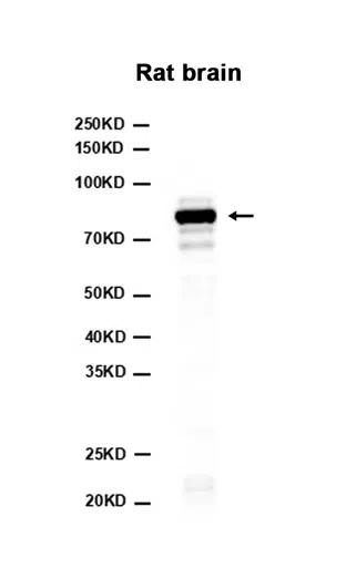 Western blot analysis of extracts from Rat brain tissue using AMRe87652 at 1:1000.