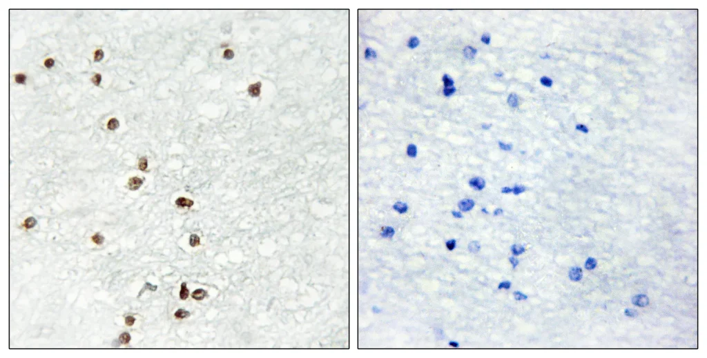 Immunohistochemistry analysis of paraffin-embedded human brain tissue, using ZIC1/2/3 Antibody. The picture on the right is blocked with the synthesized peptide.