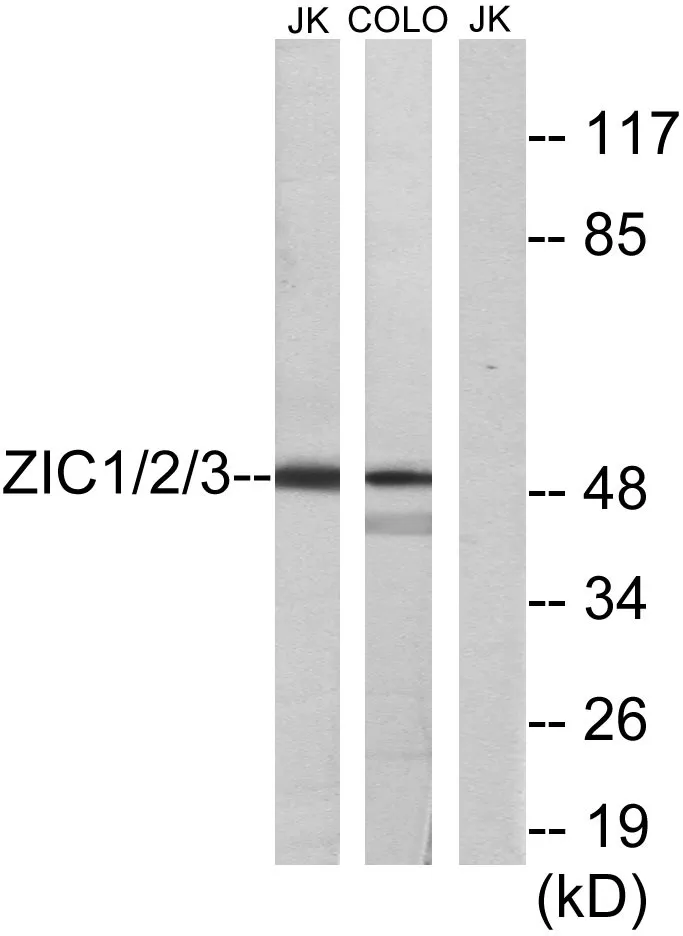 Western blot analysis of lysates from Jurkat and COLO cells, using ZIC1/2/3 Antibody. The lane on the right is blocked with the synthesized peptide.