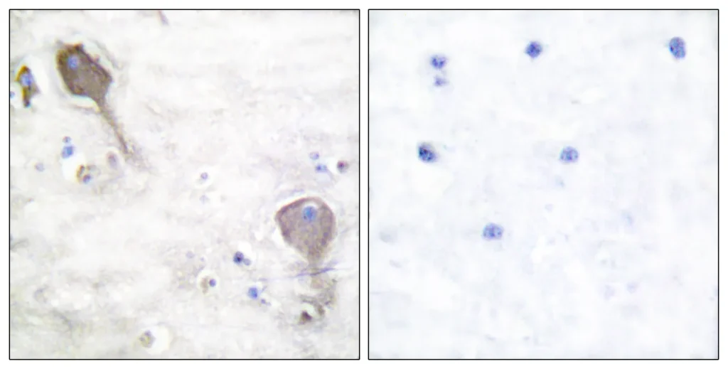 Immunohistochemistry analysis of paraffin-embedded human brain tissue, using Parkin Antibody. The picture on the right is blocked with the synthesized peptide.
