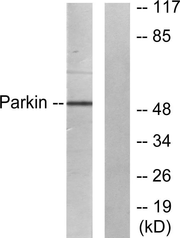 Western blot analysis of lysates from Jurkat cells, using Parkin Antibody. The lane on the right is blocked with the synthesized peptide.