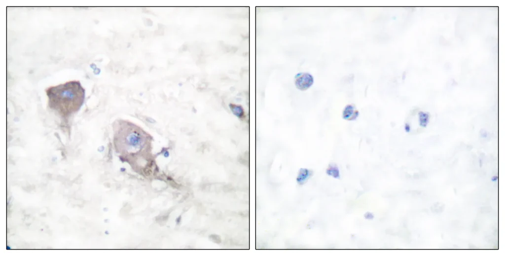 Immunohistochemistry analysis of paraffin-embedded human brain tissue, using SNAP25 Antibody. The picture on the right is blocked with the synthesized peptide.