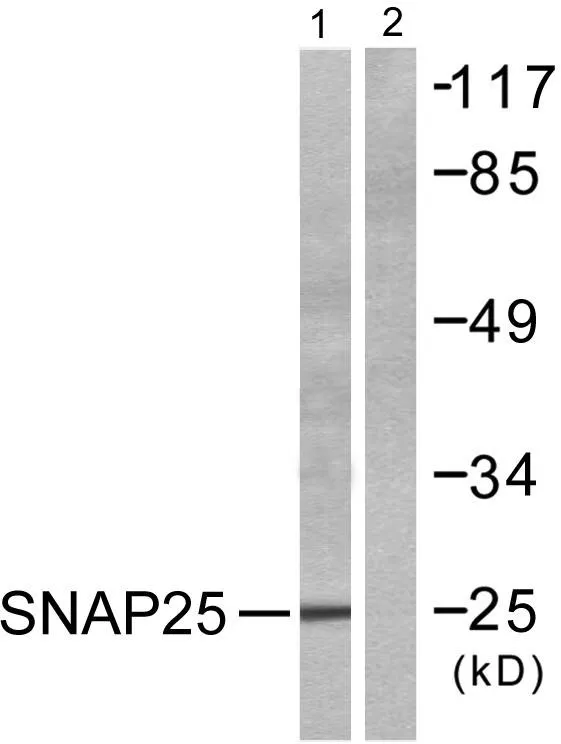 Western blot analysis of lysates from Raw264.7 cells, treated with EGF 200ng/ml 30', using SNAP25 Antibody. The lane on the right is blocked with the synthesized peptide.