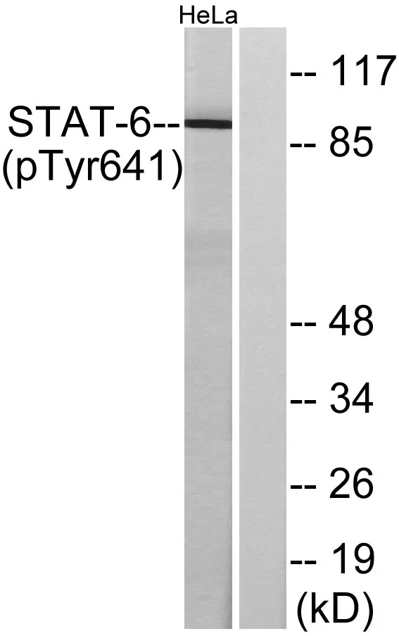 Western blot analysis of lysates from HeLa cells treated with IL-4, using STAT6 (Phospho-Tyr641) Antibody. The lane on the right is blocked with the phospho peptide.