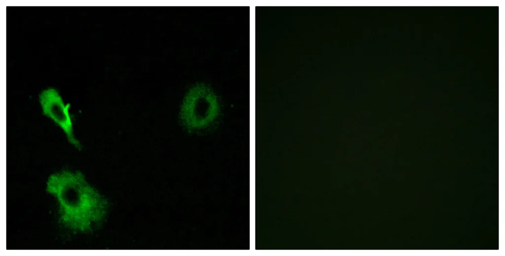 Immunofluorescence analysis of A549 cells, using GRM7 Antibody. The picture on the right is blocked with the synthesized peptide.
