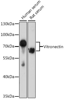 Western blot analysis of various lysates using Vitronectin Rabbit pAb at 1:1000 dilution. Secondary antibody: HRP-conjugated Goat anti-Rabbit IgG (H+L) at 1:10000 dilution. Lysates/proteins: 25μg per lane. Blocking buffer: 3% nonfat dry milk in TBST. Detection: ECL Basic Kit. Exposure time: 20s.