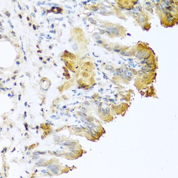 Immunohistochemistry analysis of paraffin-embedded Mouse lung using Vitronectin Rabbit pAb at dilution of 1:100 (40x lens). Microwave antigen retrieval performed with 0.01M PBS Buffer (pH 7.2) prior to IHC staining.