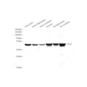 WB analysis of GFAP.Sample: Protein treated by RIPA Lysis Buffer .Blocking buffer: 3% Nonfat dry milk in TBST, RT, 1h.Primary antibody: 1: 1000, 4℃ overnight.Secondary antibody: HRP conjugated Goat Anti-Mouse lgG , 1: 5000, RT, 1h.